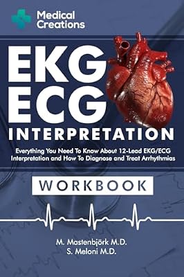 EKGECG Interpretation: Everything you Need to Know about the 12 - Lead ECGEKG Interpretation and How to Diagnose and Treat Arrhythmias: Workbook