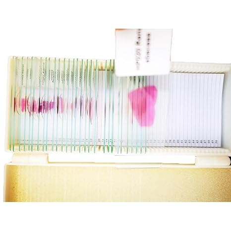 Fixed Set 30Pcs Teaching Human Pathology Microscope Prepared Slides