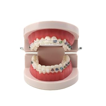 Dental Standard Teeth Model Typodont Metal/Ceramic Brackets for Demonstration (Metal and Ceramic)