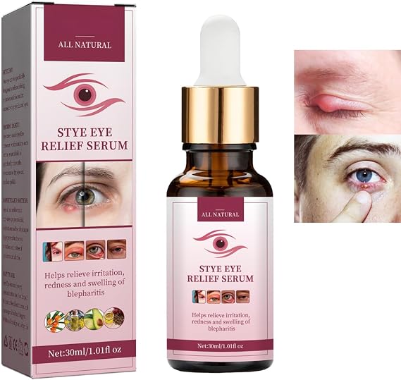 Stye Eye Treatment for Styes Chalazion&Blepharitis,Relieve Puffiness Serum | MyceliaBlepharitis,Eye Drops for Infected Eyes for StyesChalazion&Blepharitis,Daily Cleanser For Dry Eye Relief 30ml
