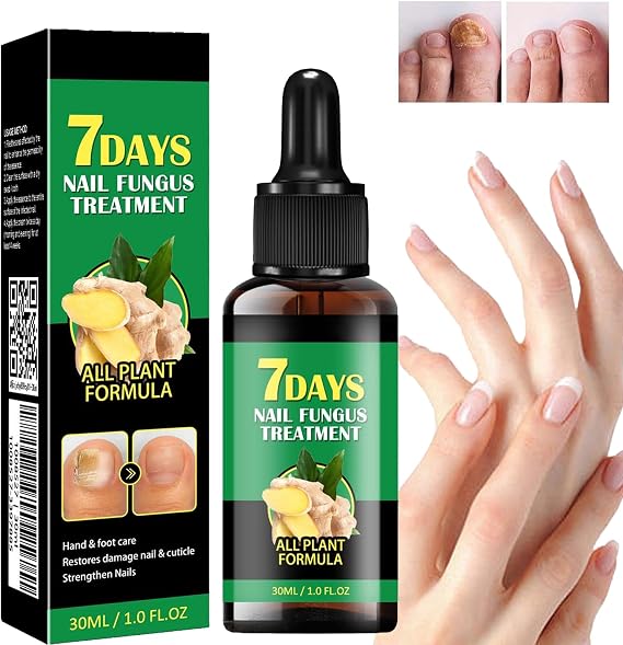Toenail Fungus Treatment Extra Strength-7 days nail fungus treatment,Ginger Nail Treatment,Toenail Cuticle Care Oil Care,Multi-Purpose Nail Repair for Your nails a Natural Shine (1Pc)